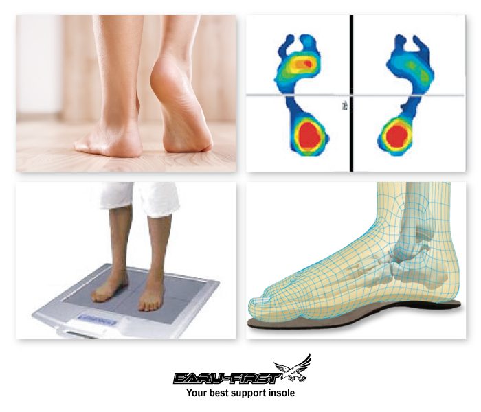 ＜FOOT-K＞姿勢改善インソール 期間限定販売会